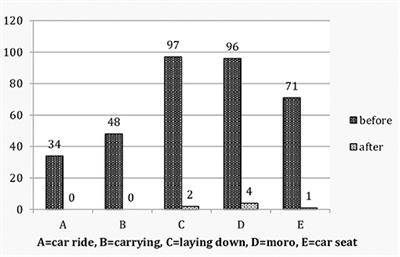Clinical Evidence of Vestibular Dysregulation in Colicky Babies Before and After Chiropractic Treatment vs. Non-colicky Babies